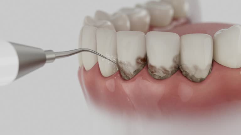 Reliable Dental Implants contractor in Camarillo, CA by Smile Center Dentistry